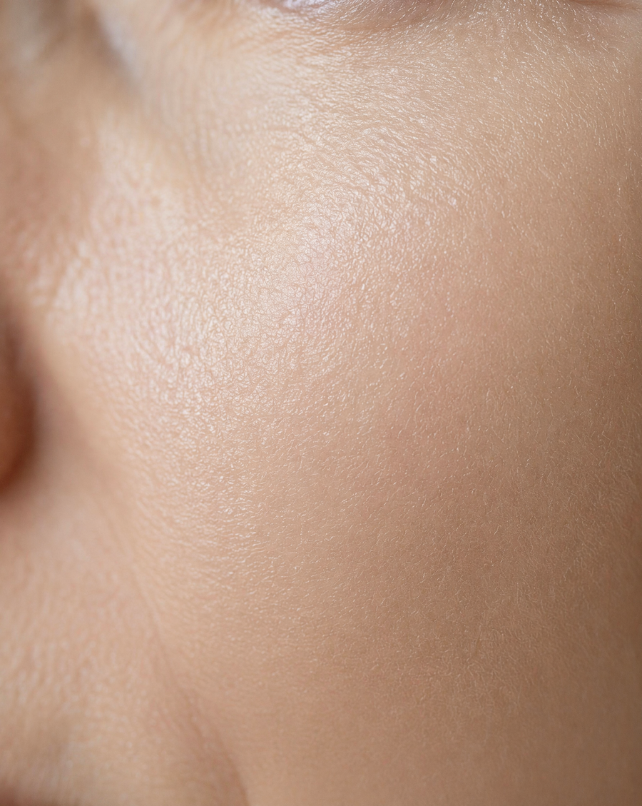 After illustration - Collagen & Fine Lines
