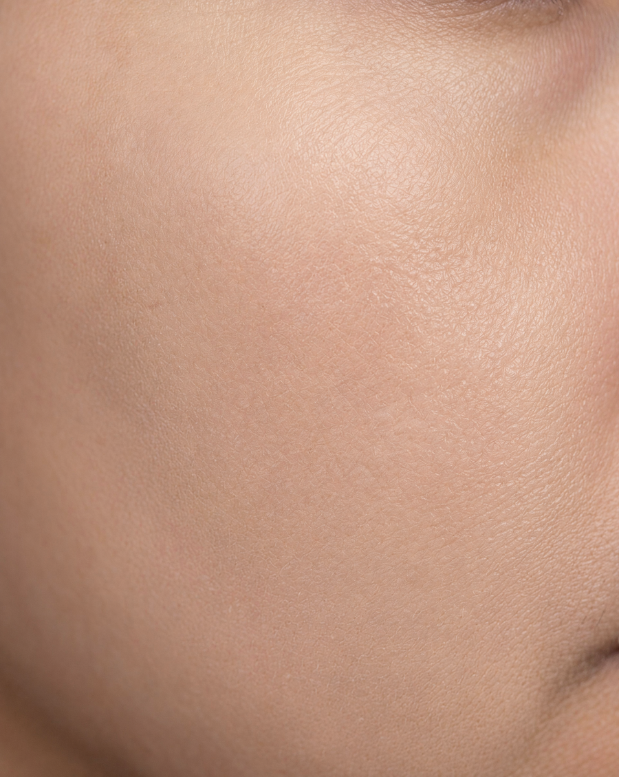 After illustration - Tone & Dark Spots